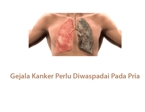 Gejala Kanker Perlu Diwaspadai
